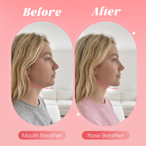 Moisturizing & Plumping Mouth Tape